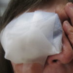 「白内障の手術」がこんなに多いとは！